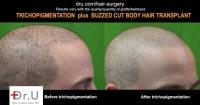 Dr U Hair & Skin Clinic image 9